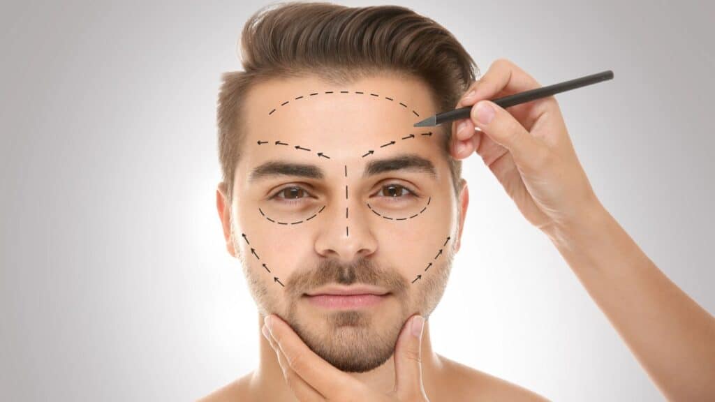 A person with facial hair is shown with dotted lines drawn on their face, while another hand uses a pencil to mark areas, suggesting preparation for cosmetic procedures.