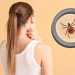 A woman scratches her neck while a large illustration of a tick under a magnifying glass appears next to her.